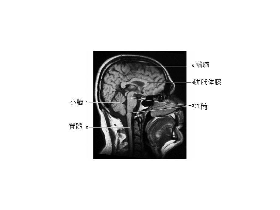 局部解剖标本考试课件.ppt_第3页