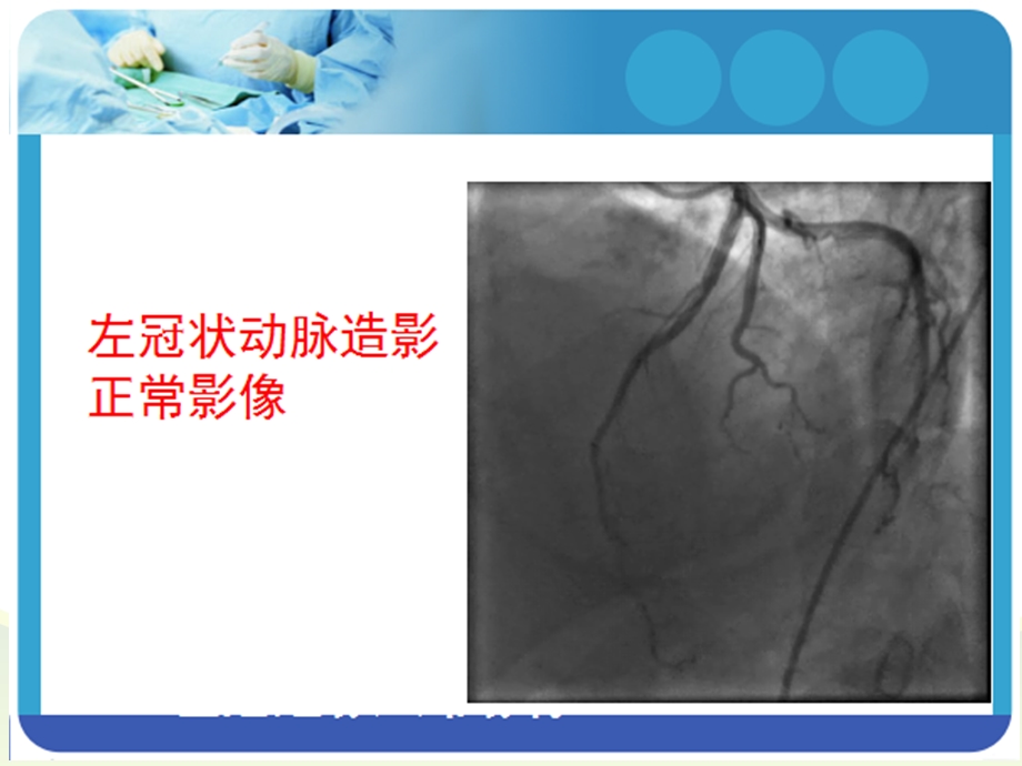 冠状动脉造影术后护理课件.ppt_第3页