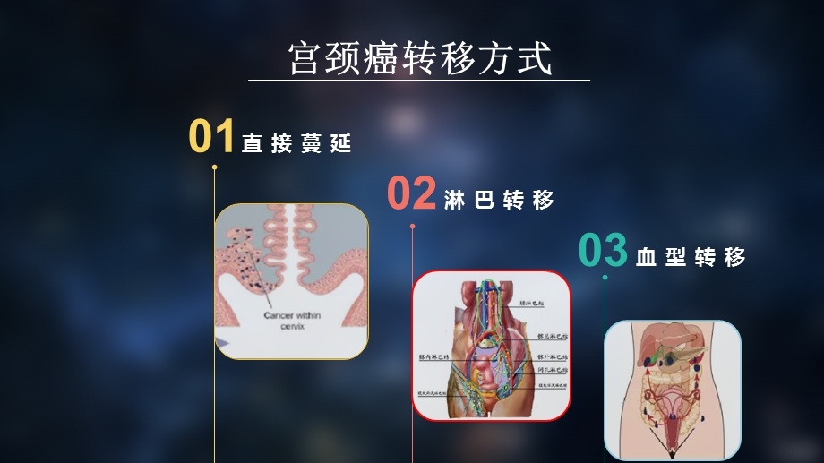 宫颈癌新分期指南课件.ppt_第3页