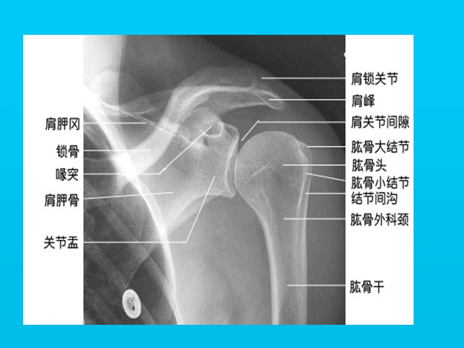 上肢骨、关节课件.ppt_第3页