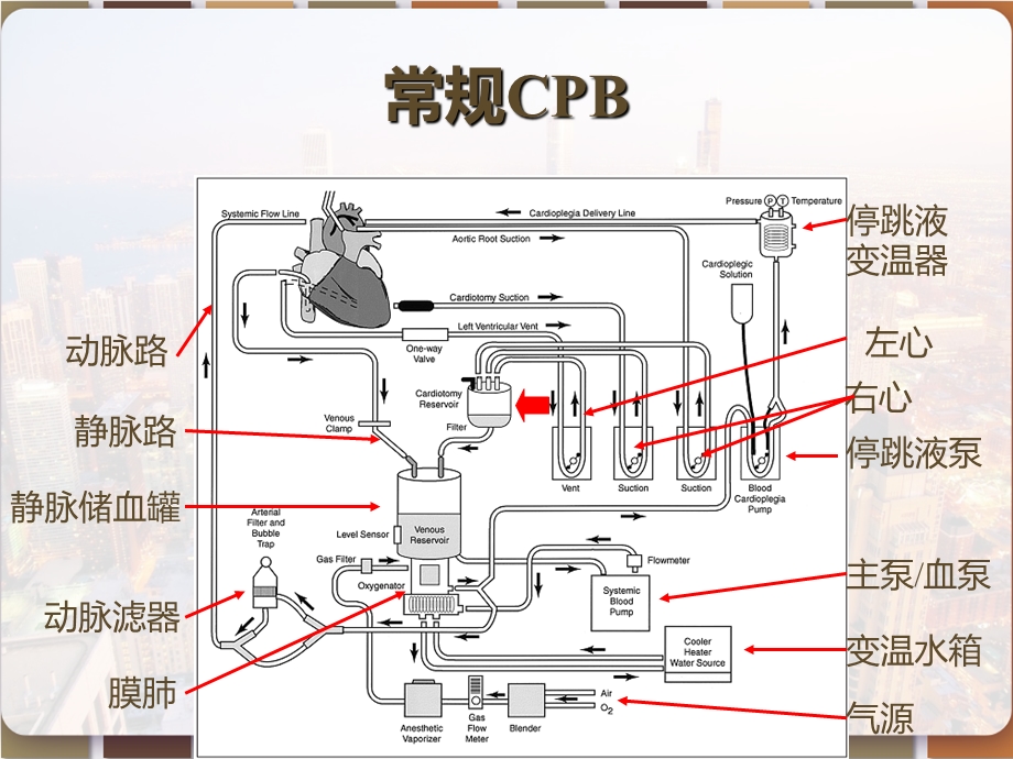 体外循环简介课件.pptx_第3页