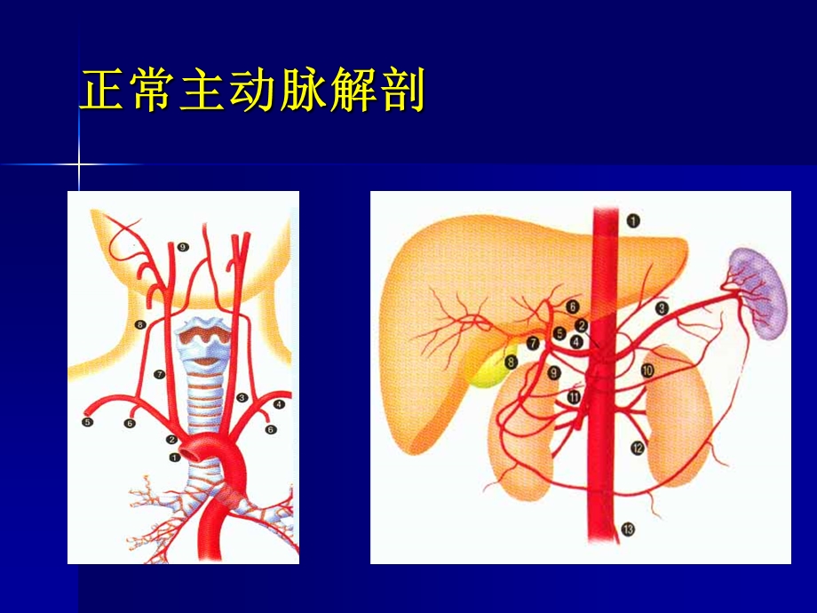 主动脉夹层及腹主动脉瘤CTA影像课件.ppt_第3页