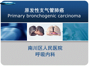 原发性支气管肺癌课件.ppt