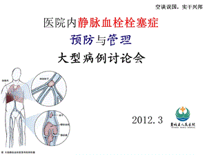 医院内静脉血栓栓塞症的预防与管理课件.ppt