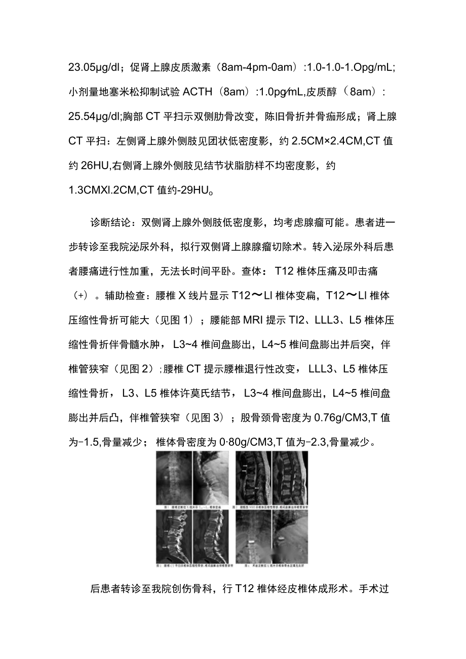 骨科医师晋升副主任（主任）医师高级职称病例分析专题报告（库欣综合征）.docx_第3页