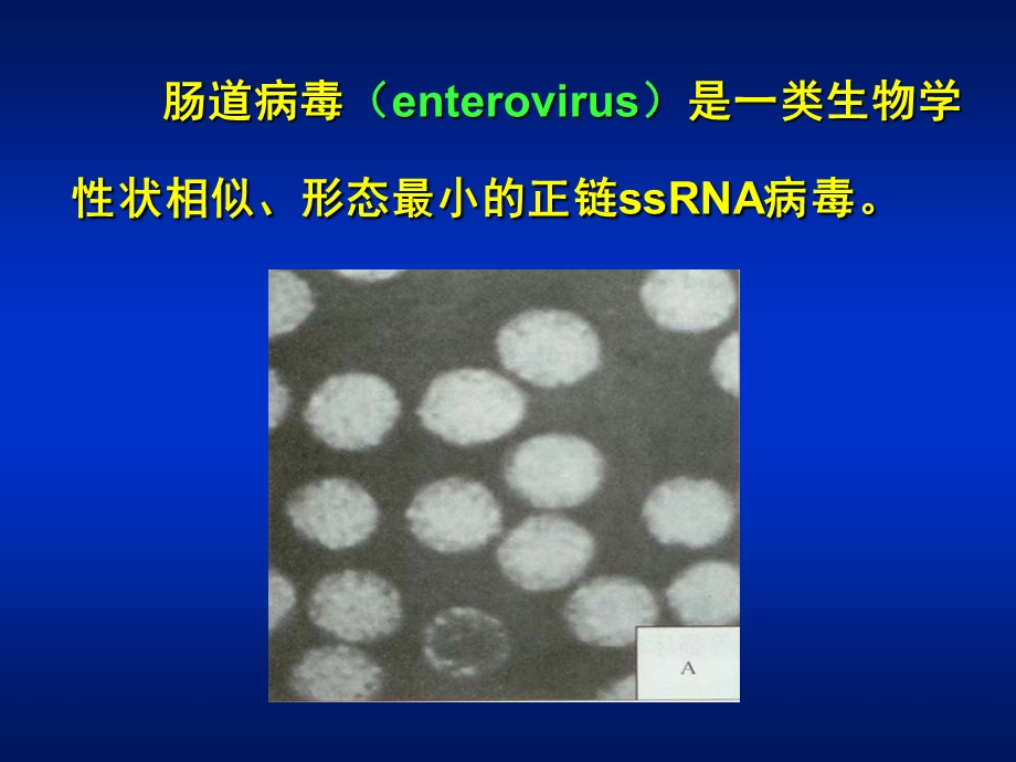 医学微生物学 第27章 肠道病毒课件.ppt_第2页