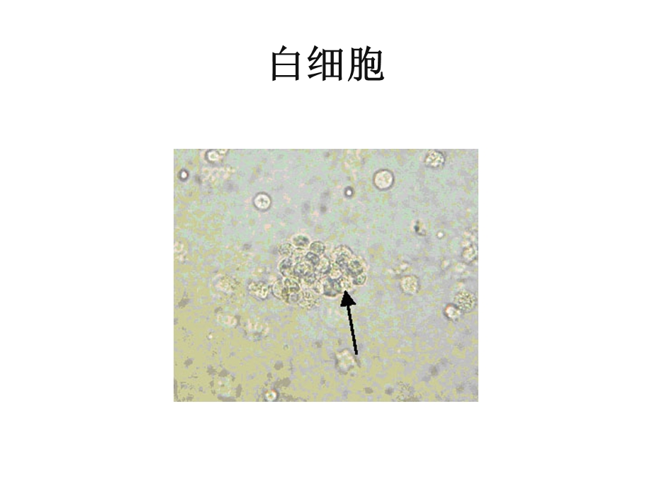 尿沉渣图谱课件.ppt_第3页