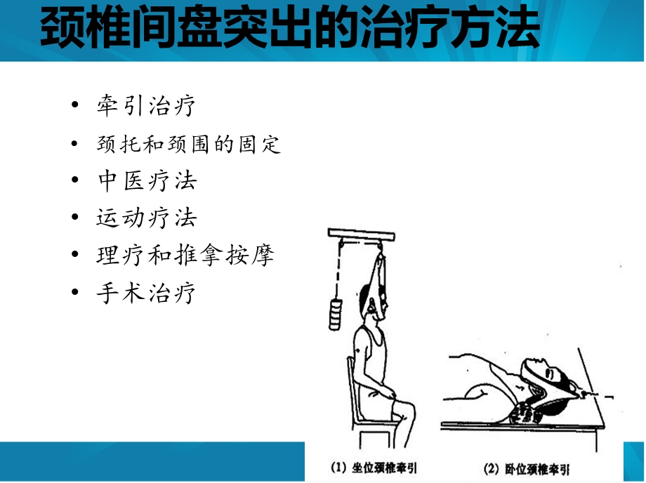 九月份颈椎病护理查房课件.ppt_第3页