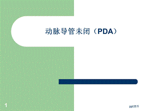 动脉导管未闭(PDA)课件.ppt