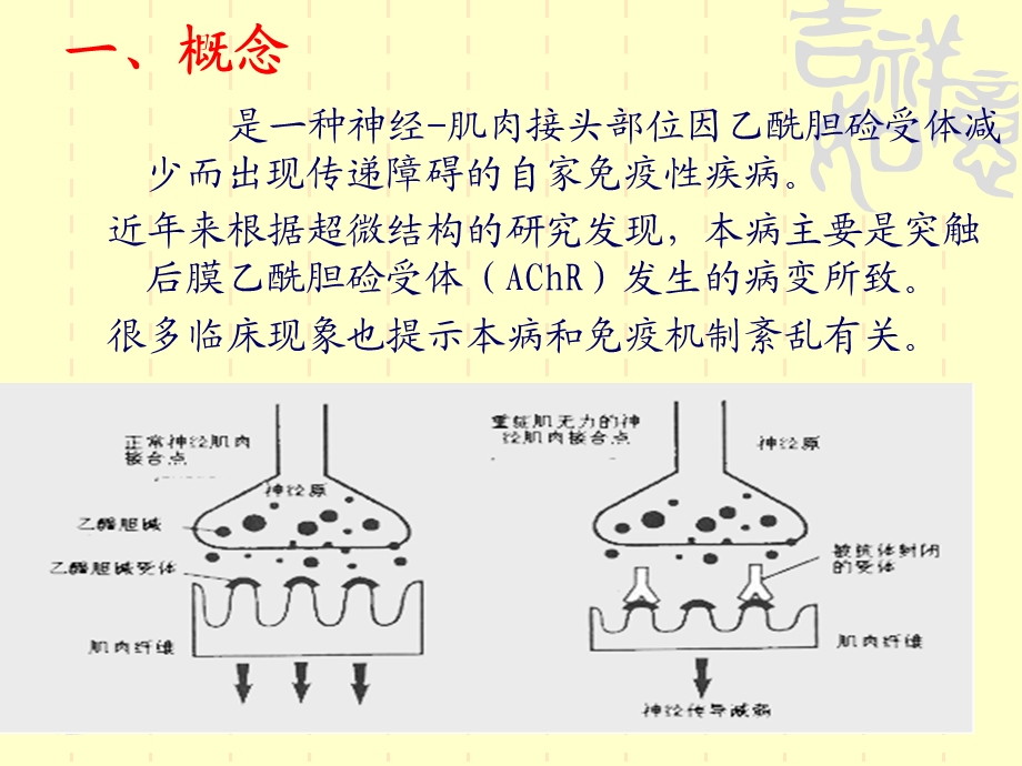 重症肌无力的护理课件.ppt_第1页