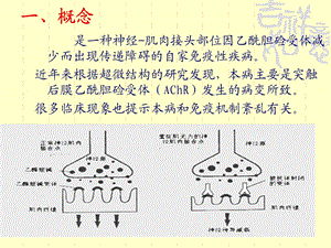 重症肌无力的护理课件.ppt