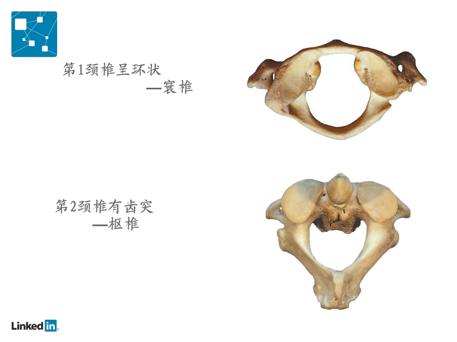 被让颈椎病降低你的工作效率课件.ppt_第2页