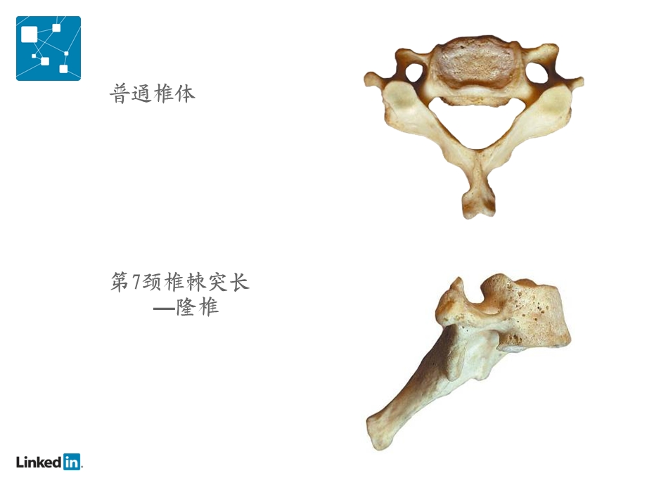 被让颈椎病降低你的工作效率课件.ppt_第3页