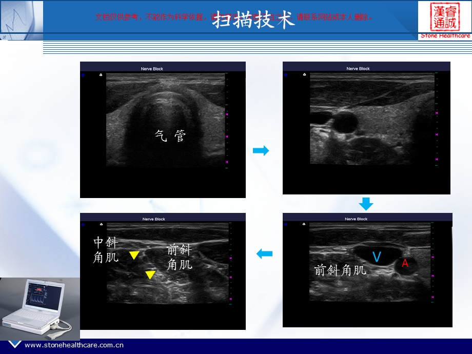 超声引导在麻醉领域的应用ppt课件.ppt_第2页