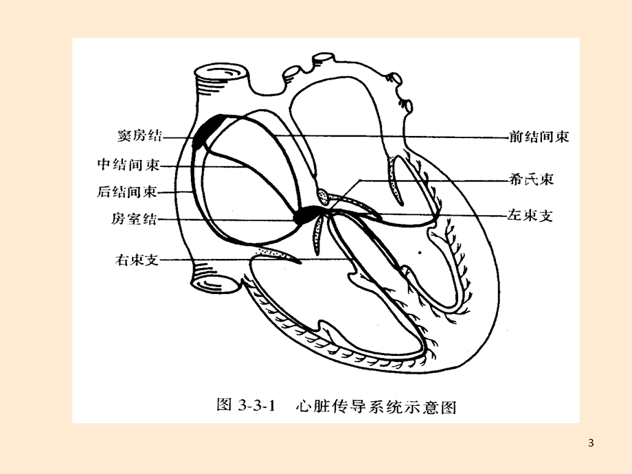 起搏器护理课件.ppt_第3页