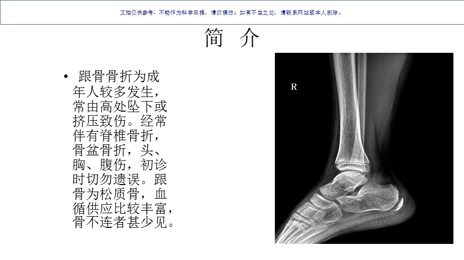 跟骨骨折患者的医疗护理查房ppt课件.ppt_第2页