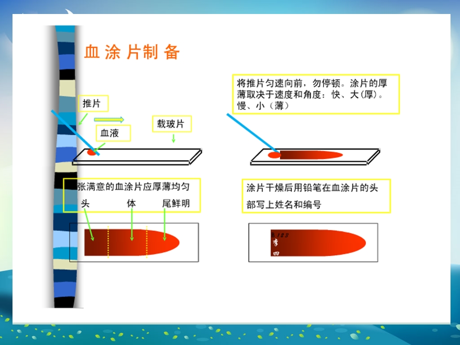 血涂片制作与染色ppt课件.ppt_第2页