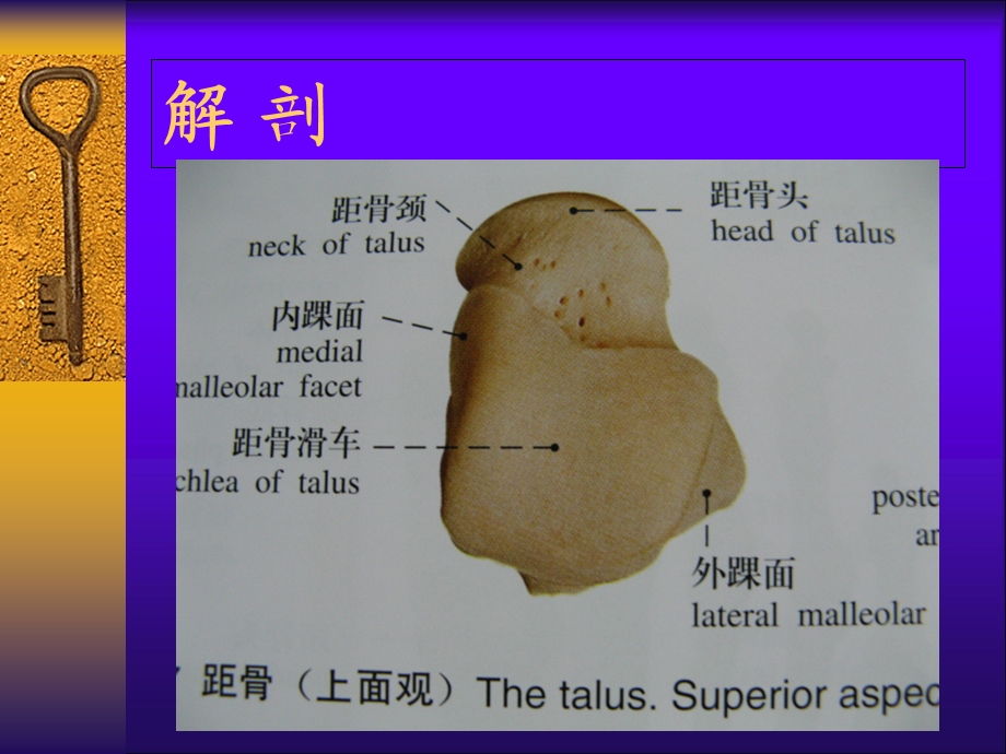 距骨骨折临床治疗 医学ppt课件.ppt_第3页