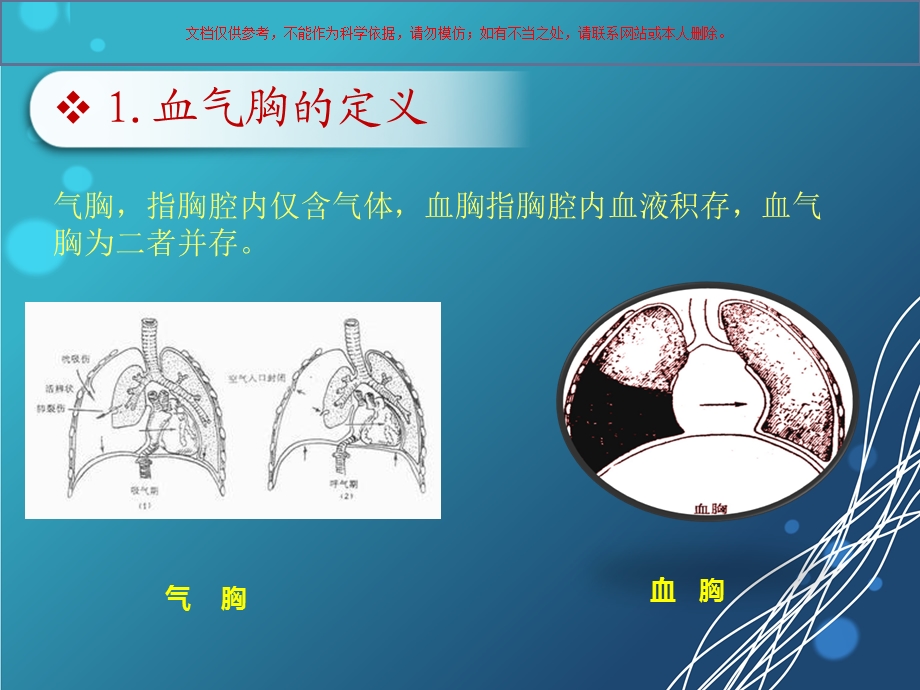 血气胸医学知识ppt课件.ppt_第2页