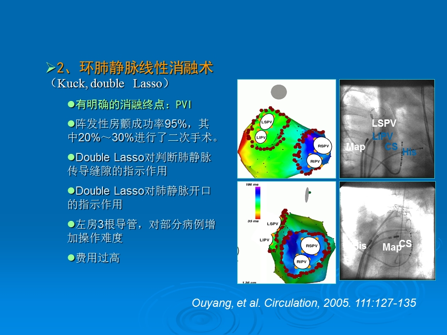 阵发性房颤射频消融ppt课件.ppt_第3页