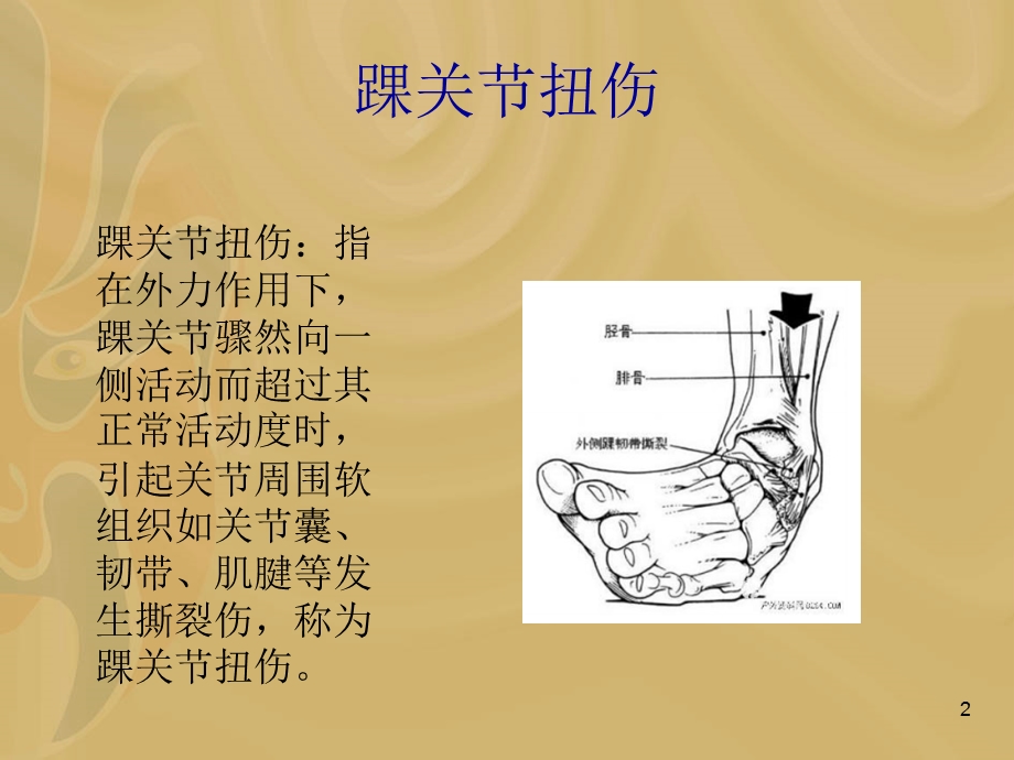 踝关节扭伤课件.ppt_第2页