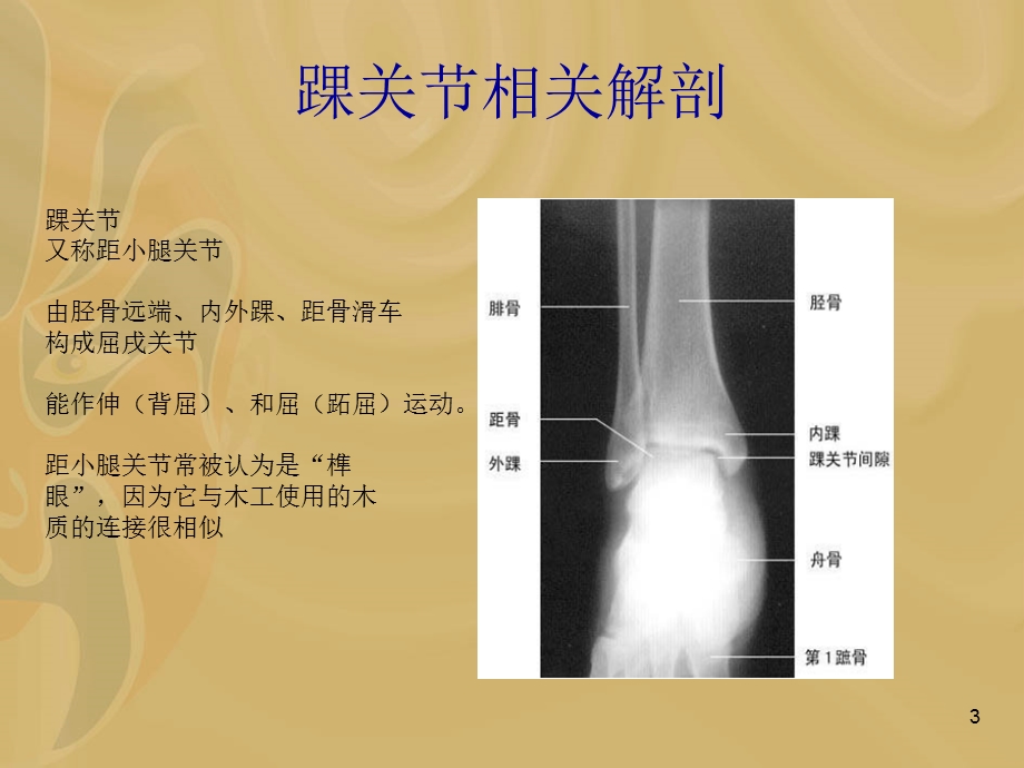 踝关节扭伤课件.ppt_第3页