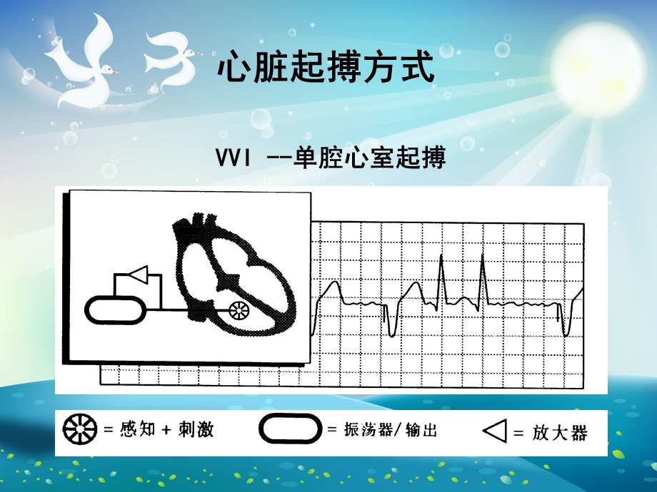 起搏器类型ppt课件.ppt_第2页