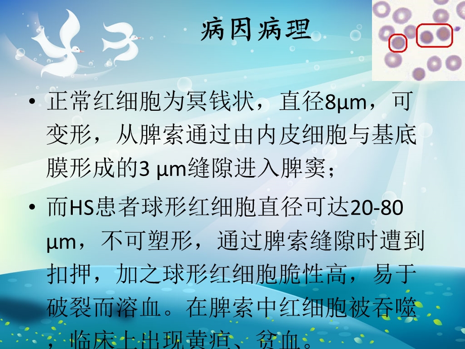 遗传性球形红细胞增多症的诊断及治疗ppt课件.ppt_第3页