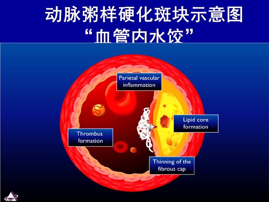 血脂异常的防治课件.ppt_第2页