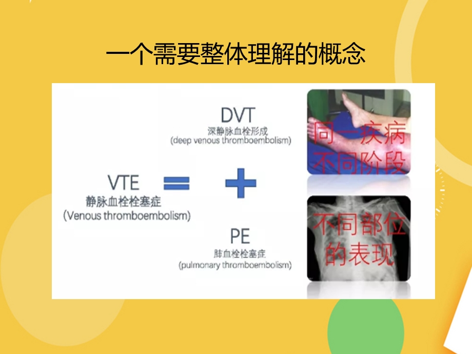 血栓的预防与管理精品PPT资料课件.pptx_第3页