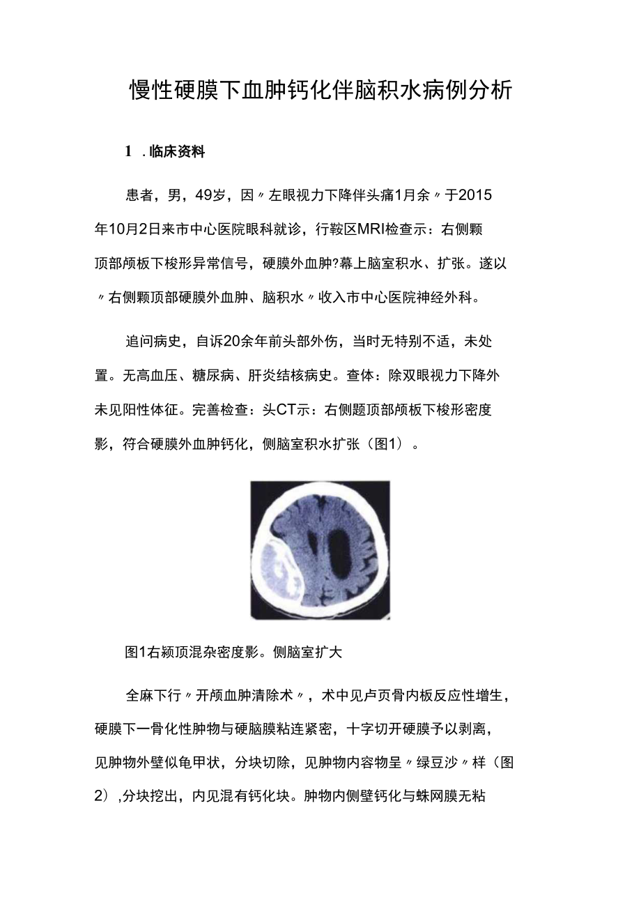 眼科医师晋升副主任（主任）医师高级职称病例分析专题报告（慢性硬膜下血肿钙化伴脑积水）.docx_第2页