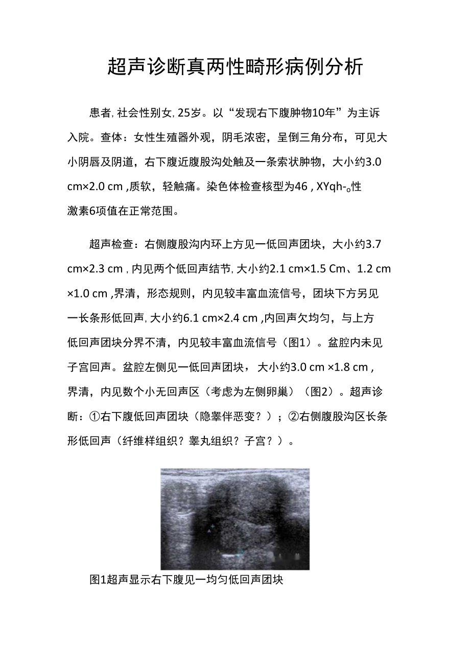 超声科医师晋升副主任（主任）医师例分析专题报告（超声诊断真两性畸形）.docx_第2页