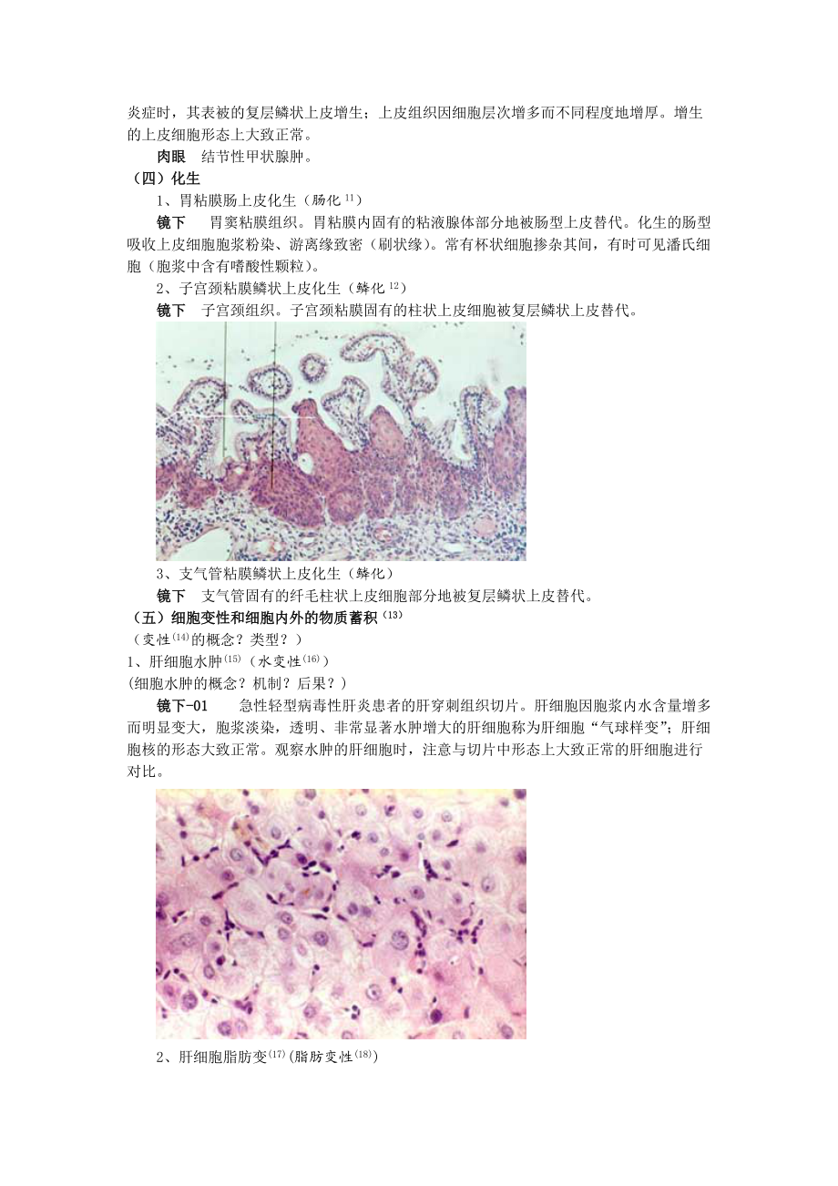 细胞、组织的适应与损伤.docx_第3页