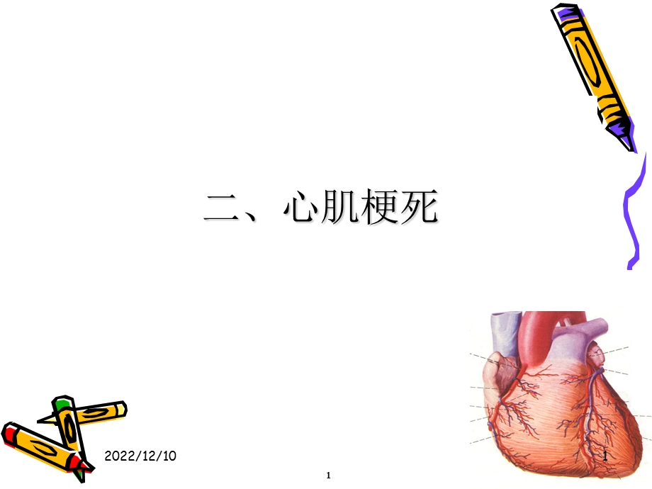 心肌梗死的护理ppt课件.ppt_第1页