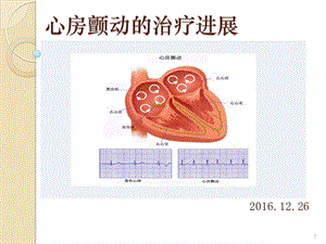 心房颤动的治疗进展ppt课件.ppt