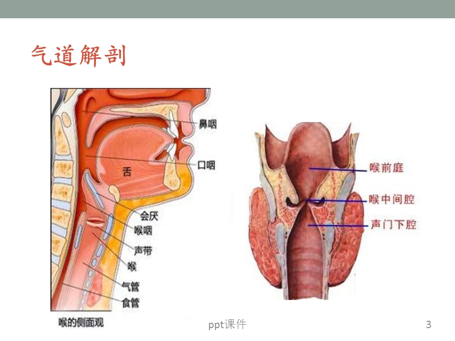 气道超声课件.ppt_第3页