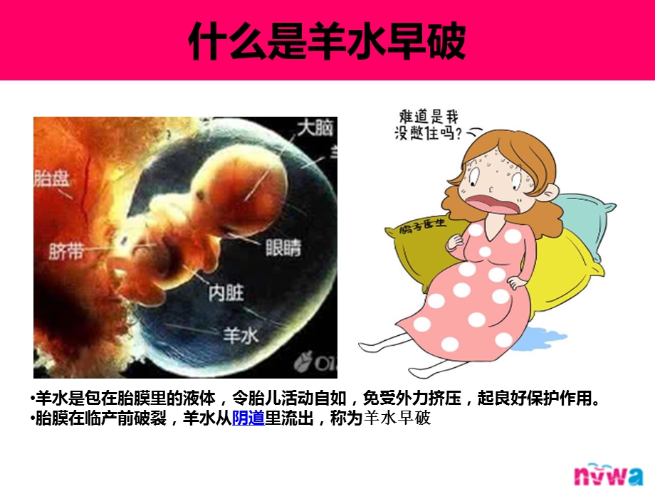 湖北女娲医学工程产前监护垫课件.ppt_第2页