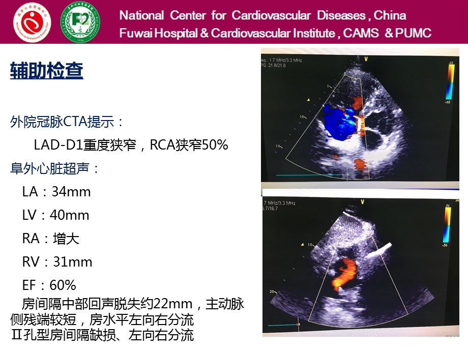 杂交手术及交叉学科的思考2016课件.pptx_第3页