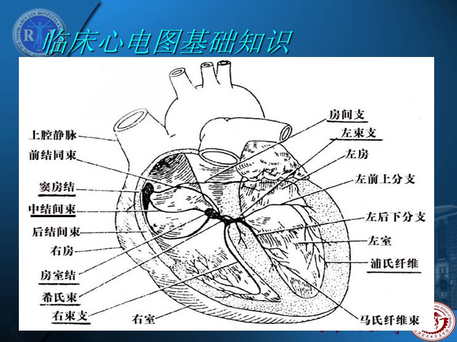 心电图培训课件.ppt_第2页