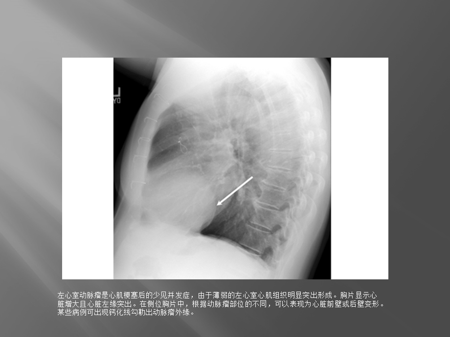 急诊常见X线表现课件.pptx_第2页