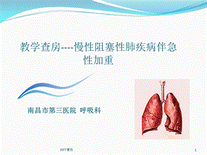 教学查房示范课件.ppt