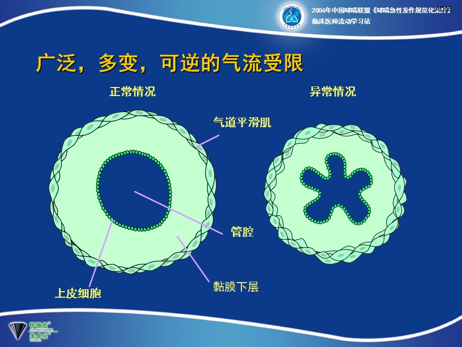 支气管扩张剂在支气管哮喘急性发作时的应用课件.ppt_第2页