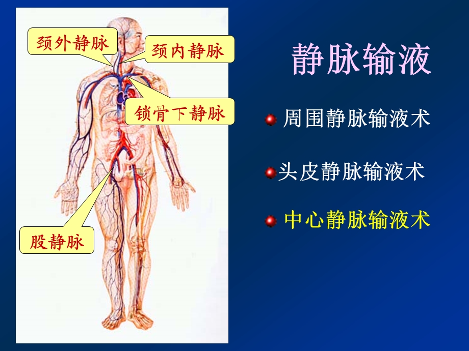 深静脉输液课件.ppt_第2页