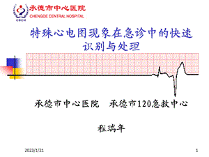 特殊心电图现象在急诊中的快速识别与处理课件.ppt