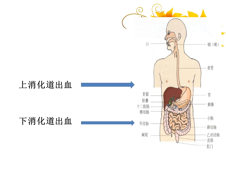 消化道出血及护理课件.ppt_第2页