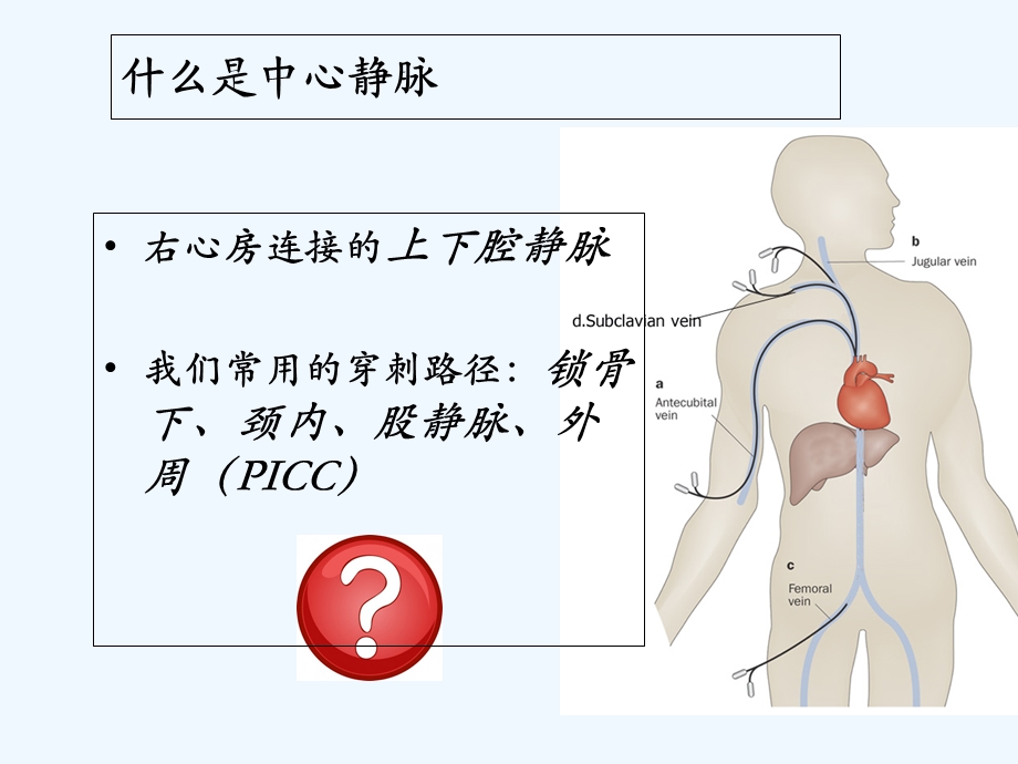 股静脉置管术课件.ppt_第2页