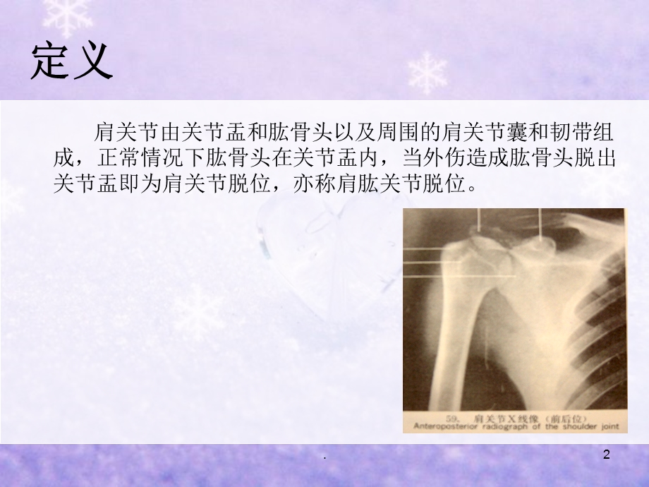 肩关节脱位的护理课件.ppt_第2页