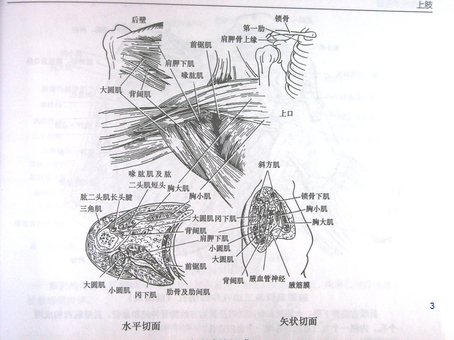 腋窝解剖及腋窝清扫课件.ppt_第3页