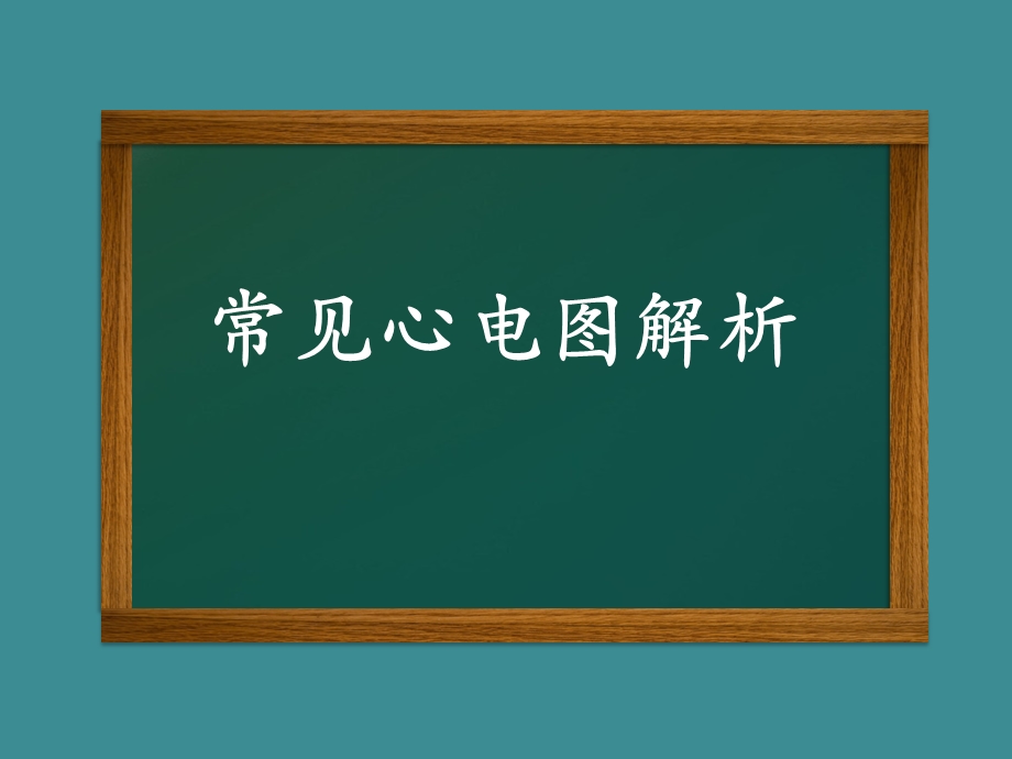 常见心电图解析课件.ppt_第1页