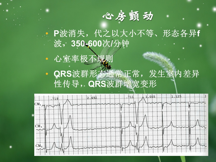 房扑与房颤心电图课件.ppt_第3页